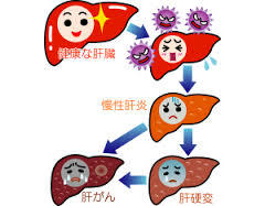 B型肝炎ワクチンについて